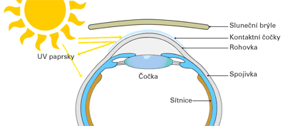 kontaktne sosovky uvfilter 2