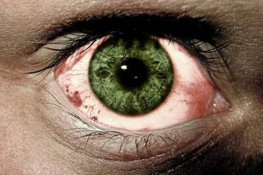 Najčastejšie ochorenia oka